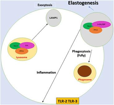 NEU1—A Unique Therapeutic Target for Alzheimer’s Disease